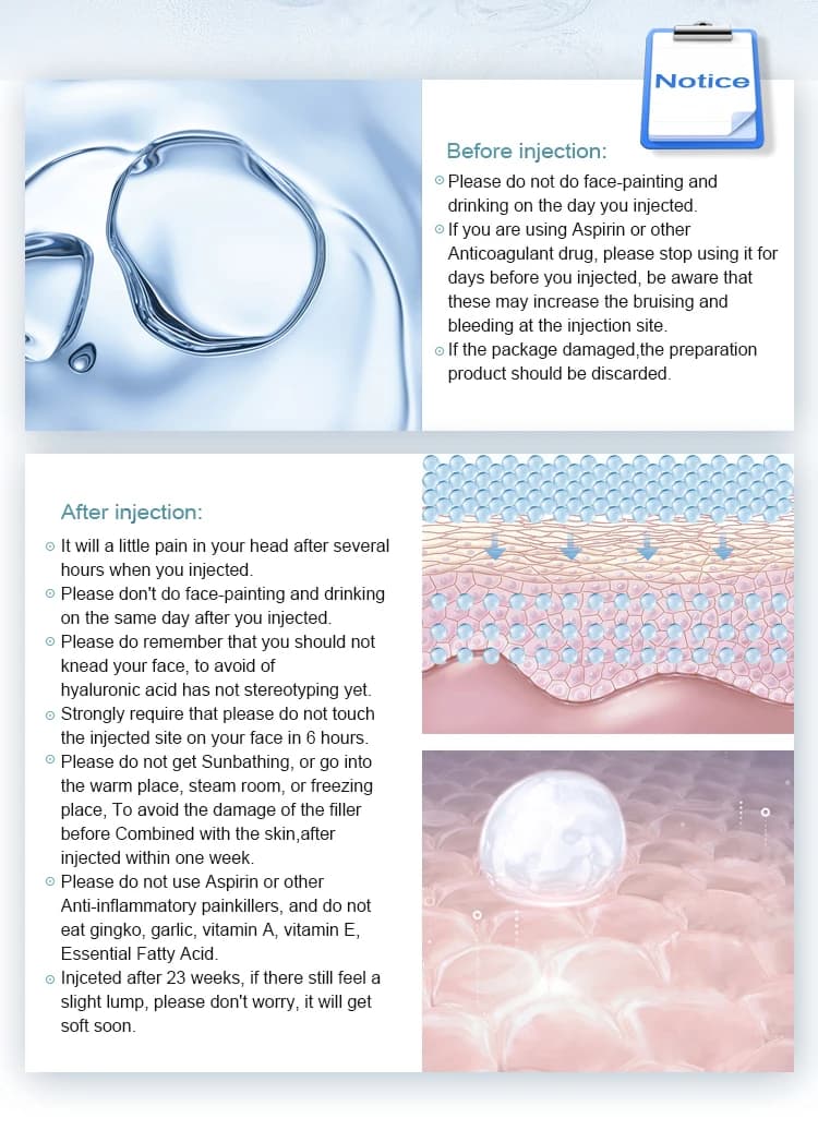 حشوات ترطيب الوجه حشوات ترطيب الوجه