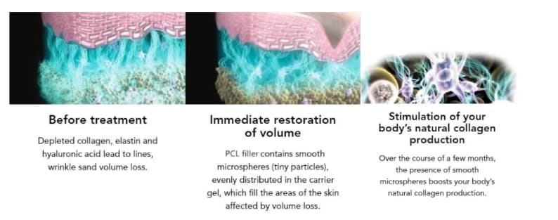 مواد مختلفة من حشو البولي كابرو لاكتون مواد مختلفة من حشو البولي كابرو لاكتون
