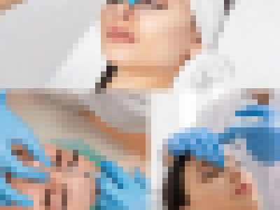 الملف التعريفي لشركة حشوات الجلد بحمض الهيالورونيك